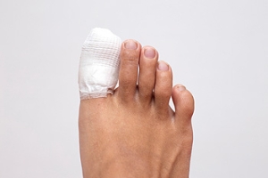 Broken Versus Jammed Toe