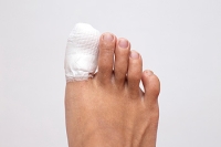 What Causes Broken Toes?