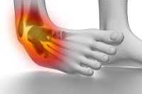Reasons and Risk Factors for Ankle Sprains