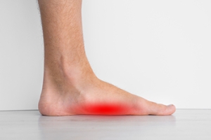 Strengthening Exercises for Improved Arch Support