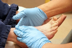 What to Know About Lower Limb Salvage Surgery