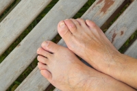 Hammertoe and Claw Toe