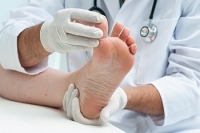 Symptoms of Athlete’s Foot